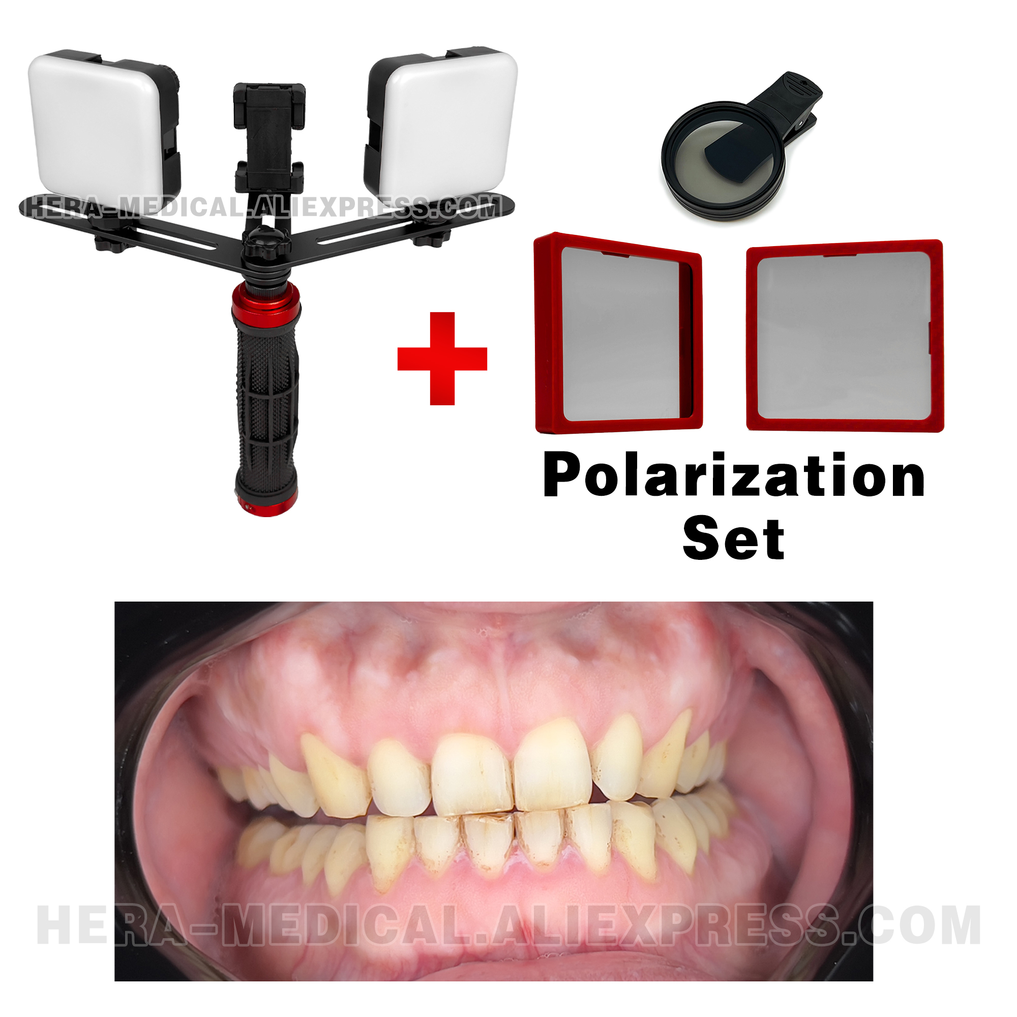Dental Photography LED Light B - Photography Equipment recensione e prezzo