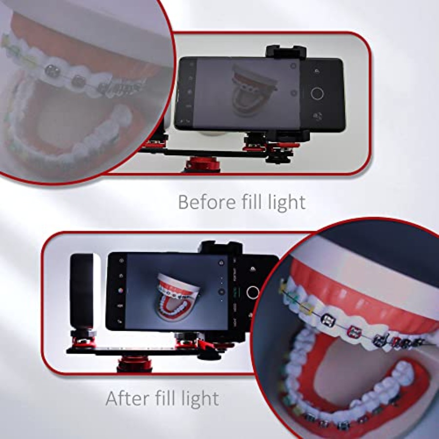 Bluetooth Dental Flash Light P - Photography Equipment recensione e prezzo