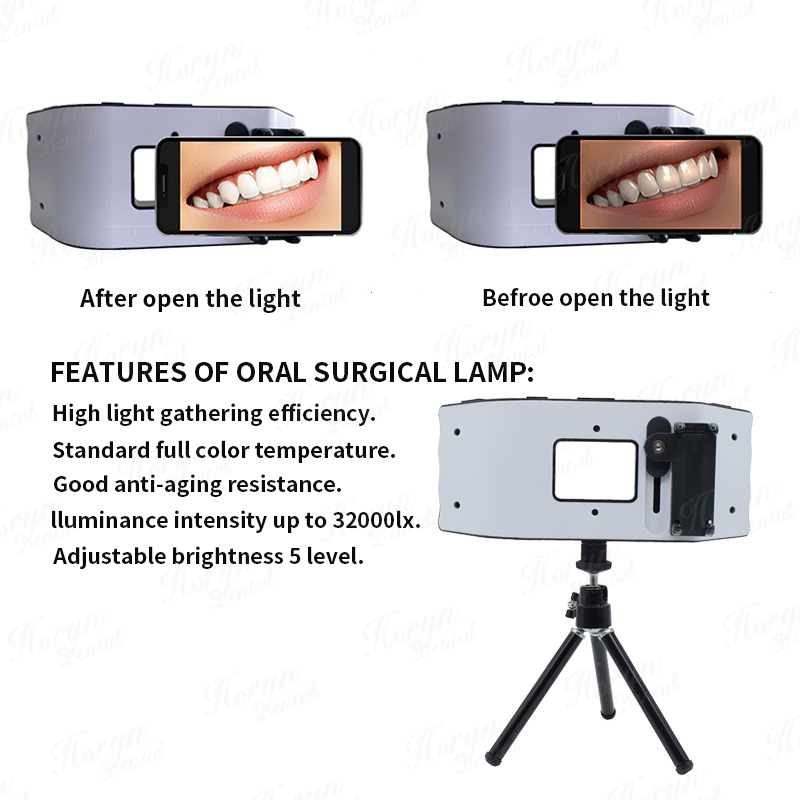 Dental Flash Light Photography - Photography Equipment recensione e prezzo